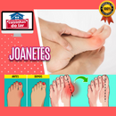 Corretor Ortopédico para Joanetes