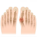 Corretor Ortopédico para Joanetes